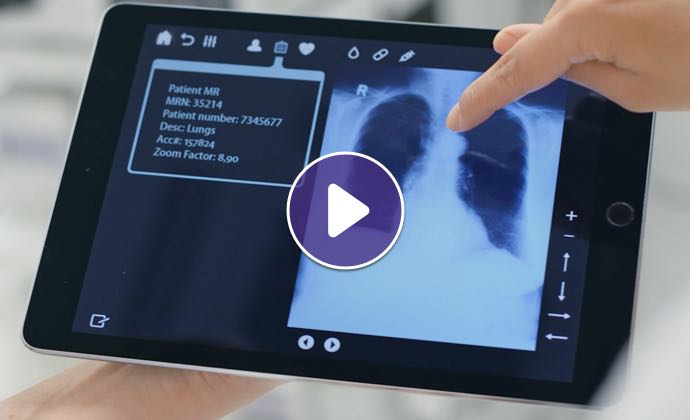 Un médico señala el escaneo de un pulmón