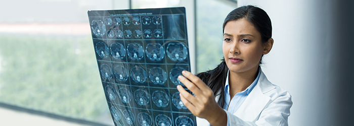 Physician looking at brain scans